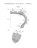 TIRE diagram and image