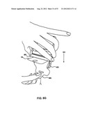 PROTECTIVE MATERIAL APPLICATOR DEVICE diagram and image