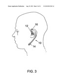 DEVICE FOR THE TREATMENT OF SLEEP-RELATED CONDITIONS diagram and image