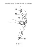 DEVICE FOR THE TREATMENT OF SLEEP-RELATED CONDITIONS diagram and image