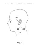 DEVICE FOR THE TREATMENT OF SLEEP-RELATED CONDITIONS diagram and image