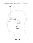 DEVICE FOR THE TREATMENT OF SLEEP-RELATED CONDITIONS diagram and image