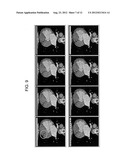 MOTION INDEX FOR MEDICAL IMAGING DATA BASED UPON GRANGEAT S FORMULA diagram and image