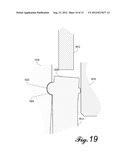 PIPETTE AND SEALING TIP diagram and image