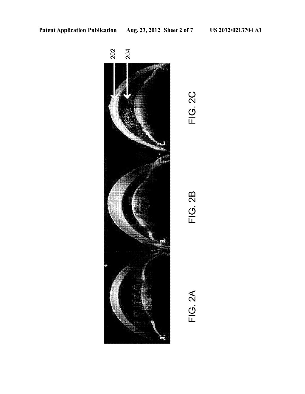 SYSTEM AND METHOD FOR MOLECULAR IN VIVO IMAGING AND THERANOSTICS - diagram, schematic, and image 03