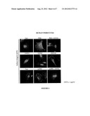 TREATMENT OF RENAL DISEASES diagram and image