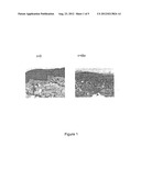 USE OF PUFAS FOR TREATING SKIN INFLAMMATION diagram and image