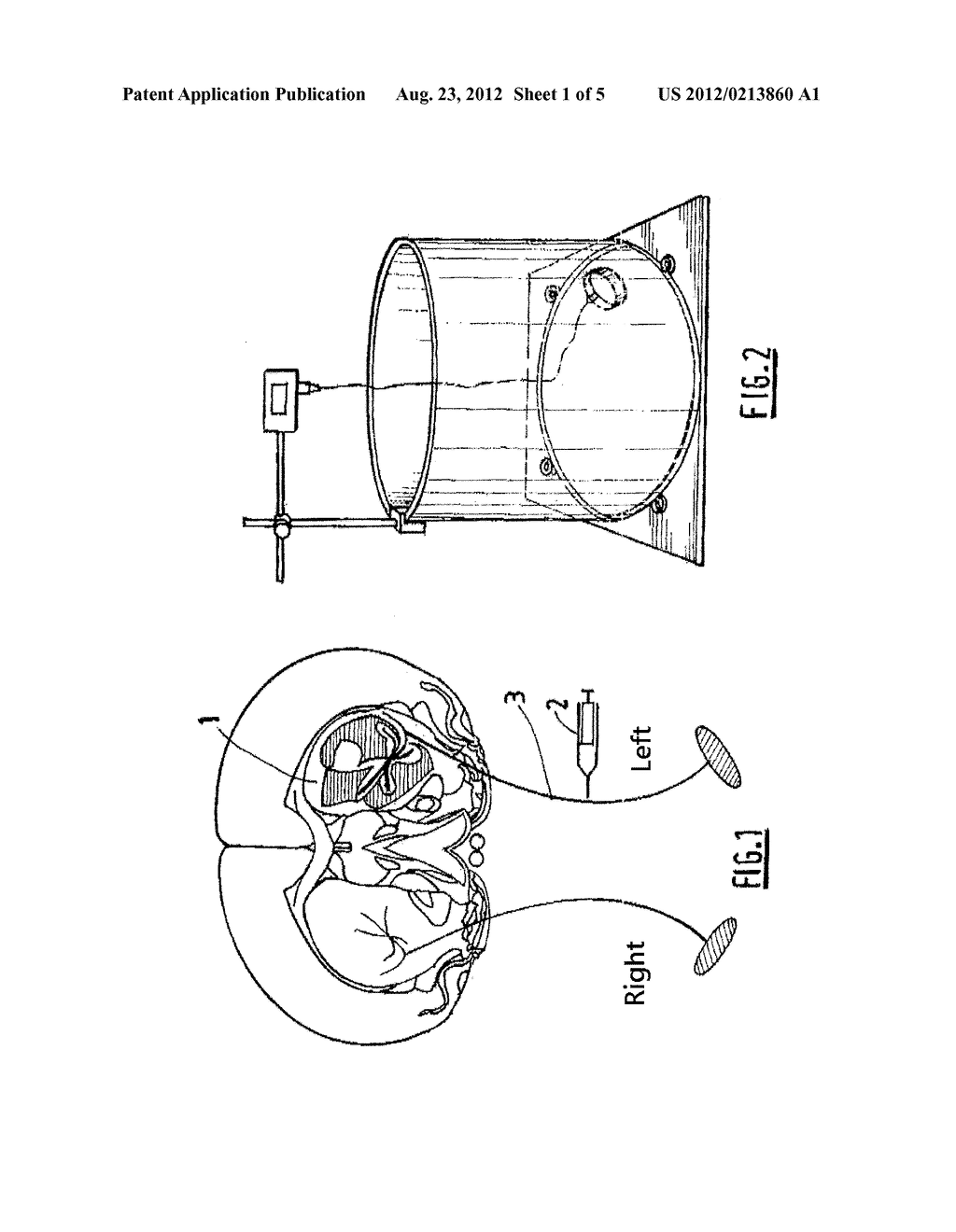 XENON-BASED INHALABLE DRUG FOR TREATING OR PREVENTING INDUCED DYSKINESIA - diagram, schematic, and image 02