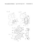 Method and Apparatus for a Removable and Interchangeable Accessory     Addition diagram and image