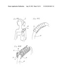 Method and Apparatus for a Removable and Interchangeable Accessory     Addition diagram and image