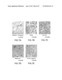 DETECTION OF HIV-RELATED PROTEINS IN URINE diagram and image