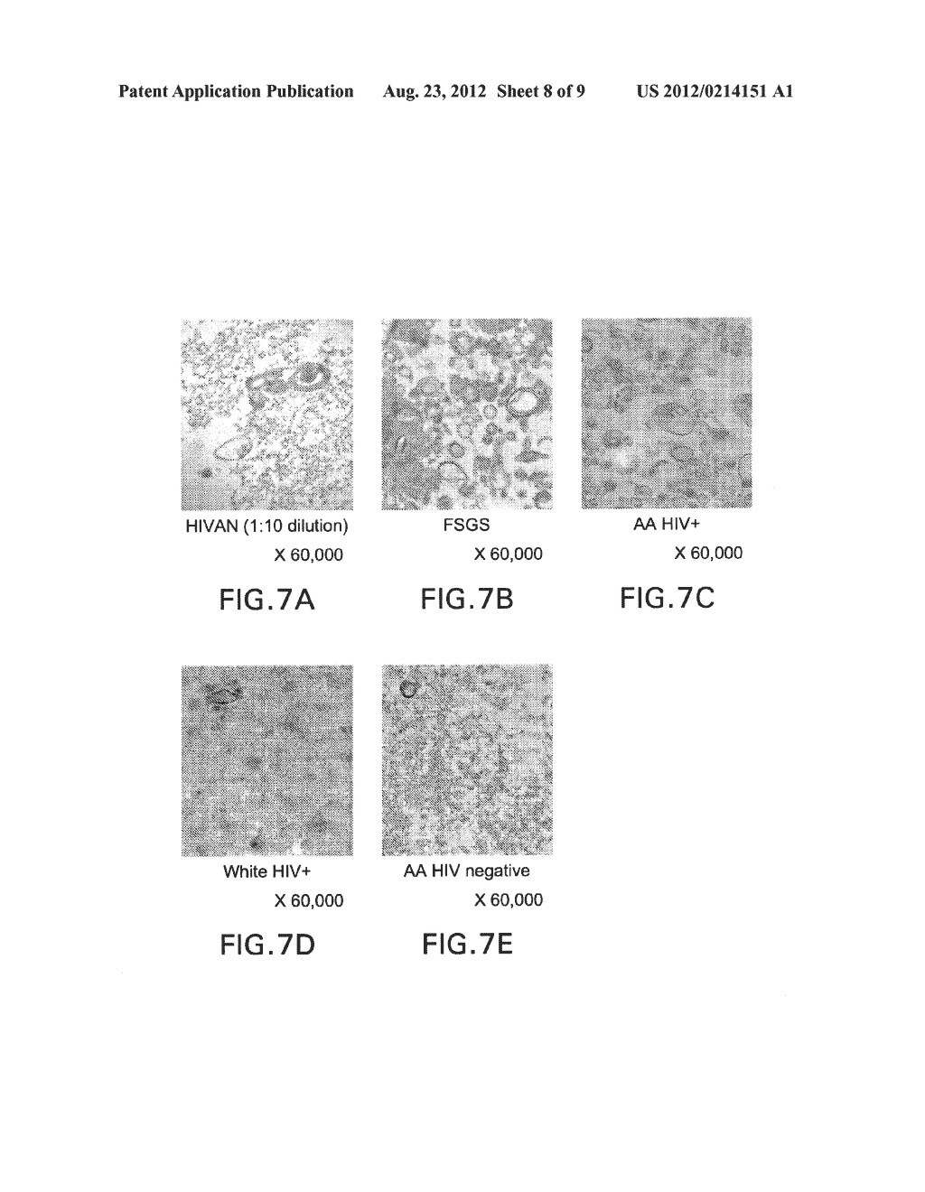 DETECTION OF HIV-RELATED PROTEINS IN URINE - diagram, schematic, and image 09