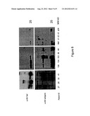 DETECTION OF HIV-RELATED PROTEINS IN URINE diagram and image