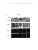 Methods and Compositions for the Diagnosis and Treatment of Thyroid Cancer diagram and image