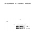 Methods and Compositions for the Diagnosis and Treatment of Thyroid Cancer diagram and image