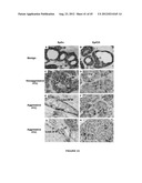 Methods and Compositions for the Diagnosis and Treatment of Thyroid Cancer diagram and image