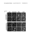 GENE AND POLYPEPTIDE RELATING TO BREAST CANCER diagram and image