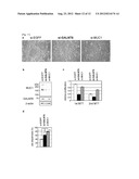 GENE AND POLYPEPTIDE RELATING TO BREAST CANCER diagram and image