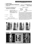 IN SITU TISSUE ENGINEERING USING MAGNETICALLY GUIDED THREE DIMENSIONAL     CELL PATTERNING diagram and image