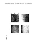 IN SITU TISSUE ENGINEERING USING MAGNETICALLY GUIDED THREE DIMENSIONAL     CELL PATTERNING diagram and image