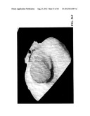 MOLLUSC PROCESSING APPARATUS AND RELATED METHODS diagram and image