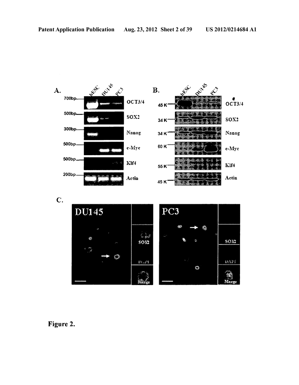 COMPOSITIONS AND METHODS FOR DETECTING AND TREATING PROSTATE CARCINOMA - diagram, schematic, and image 03