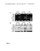 COMPOSITIONS AND METHODS FOR DETECTING AND TREATING PROSTATE CARCINOMA diagram and image