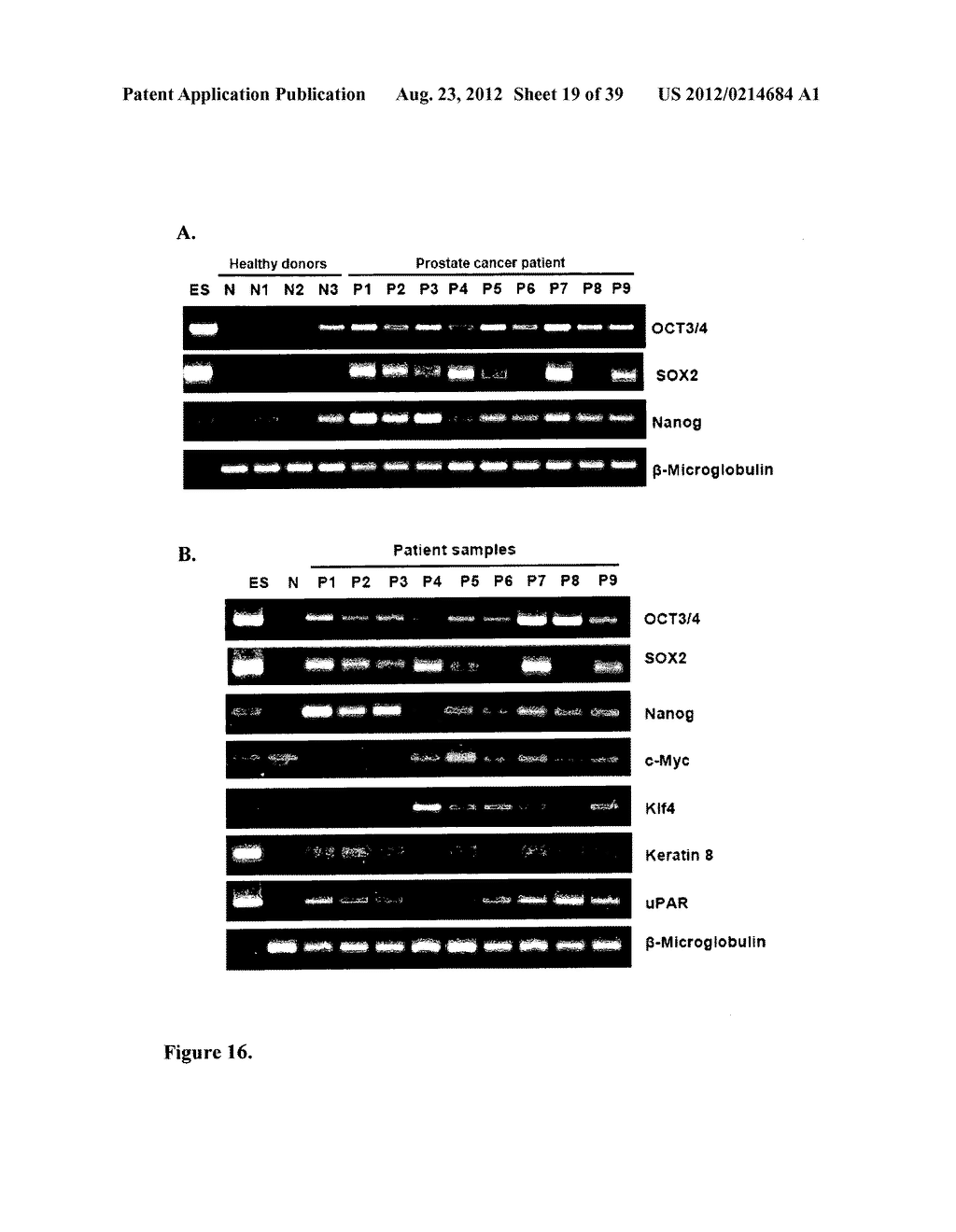 COMPOSITIONS AND METHODS FOR DETECTING AND TREATING PROSTATE CARCINOMA - diagram, schematic, and image 20