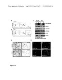 COMPOSITIONS AND METHODS FOR DETECTING AND TREATING PROSTATE CARCINOMA diagram and image