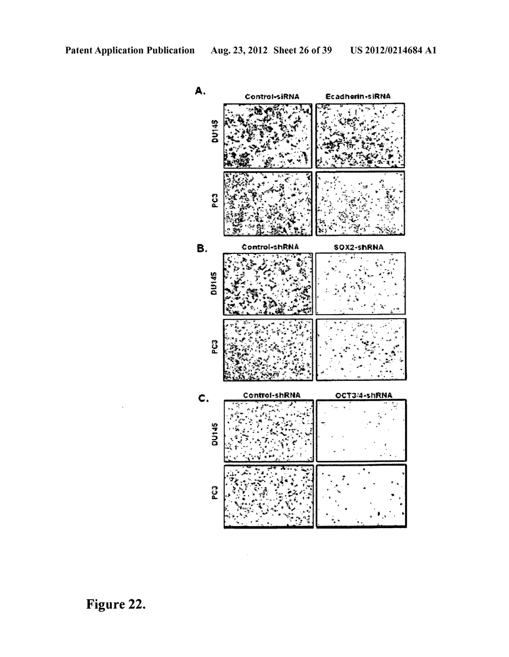 COMPOSITIONS AND METHODS FOR DETECTING AND TREATING PROSTATE CARCINOMA - diagram, schematic, and image 27