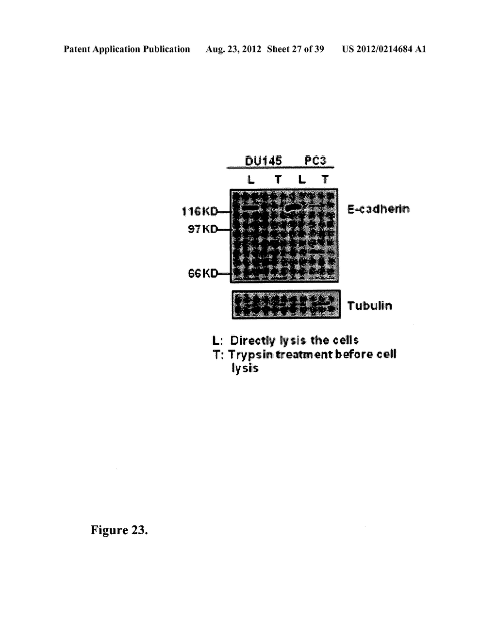 COMPOSITIONS AND METHODS FOR DETECTING AND TREATING PROSTATE CARCINOMA - diagram, schematic, and image 28