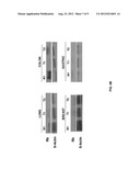 Methods for Diagnosing Breast Cancer Using miR-21, miR-125-1, miR-125b-2     and miR-145 diagram and image