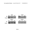 Methods for Diagnosing Stomach Cancer Using MicroRNA Signatures diagram and image