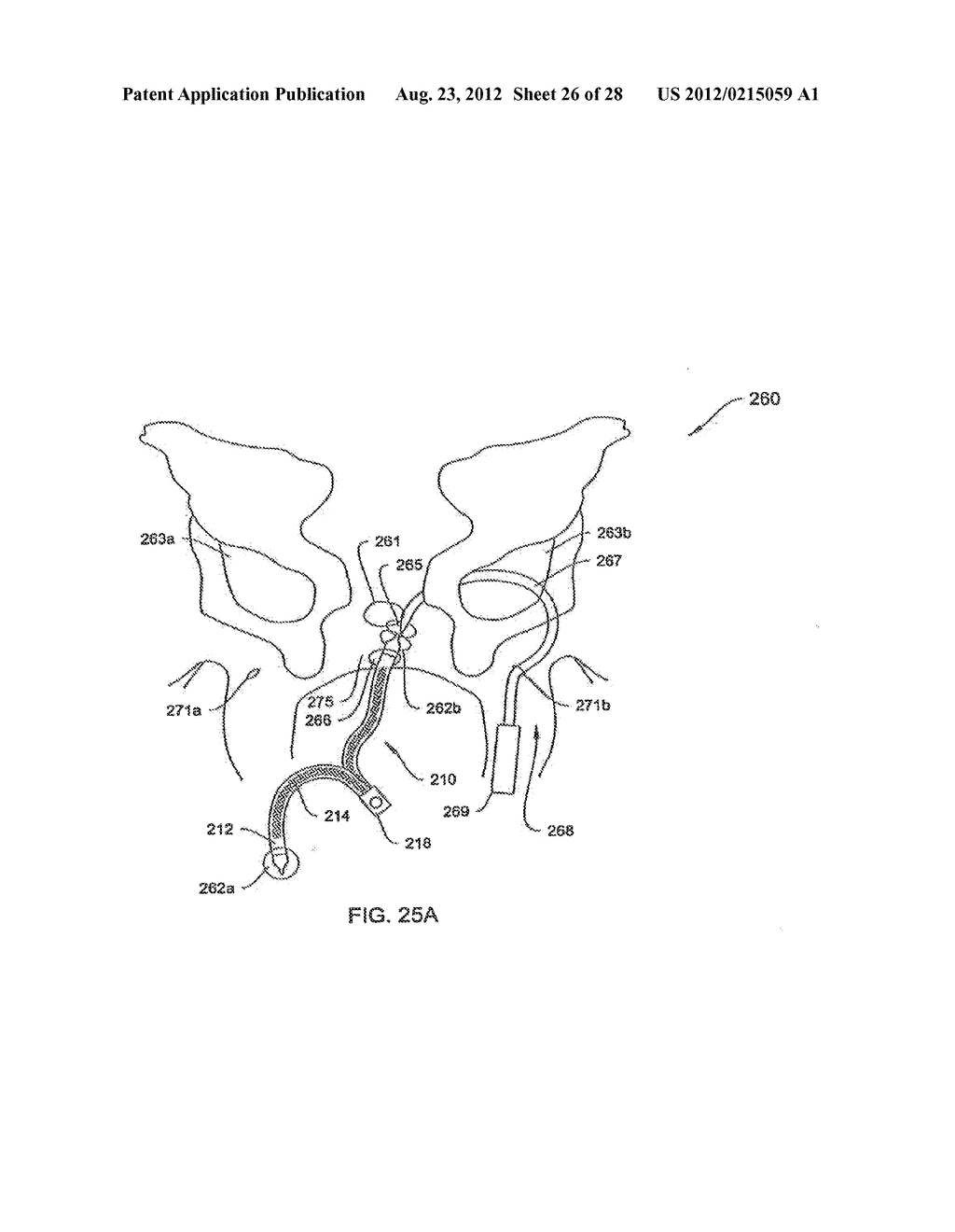 SYSTEMS AND METHODS FOR DELIVERING A MEDICAL IMPLANT TO AN ANATOMICAL     LOCATION IN A PATIENT - diagram, schematic, and image 27