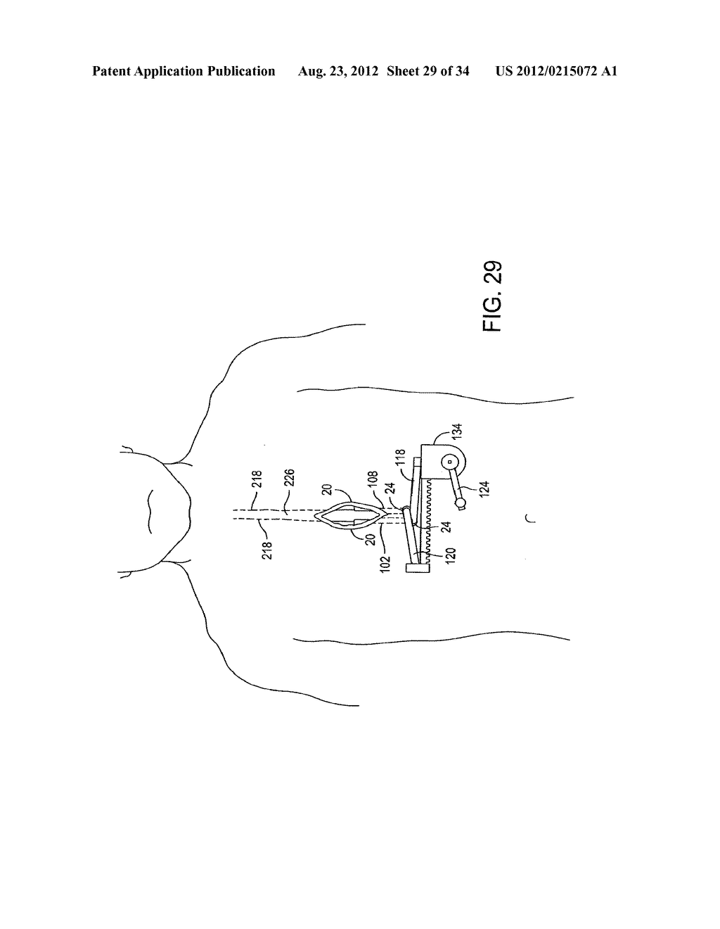 METHODS AND APPARATUS FOR PERFORMING MINIMALLY INVASIVE SURGERY - diagram, schematic, and image 30