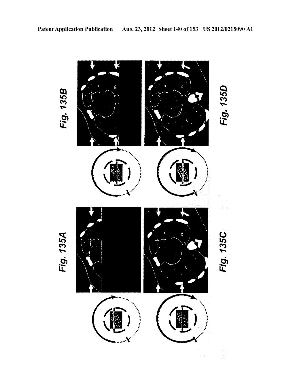 IMAGING SYSTEM - diagram, schematic, and image 141