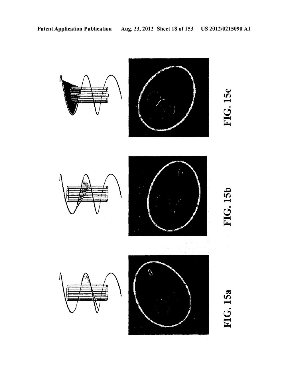 IMAGING SYSTEM - diagram, schematic, and image 19