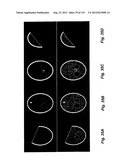 IMAGING SYSTEM diagram and image