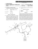 Methods and Apparatus for Endovascular Ultrasound Delivery diagram and image