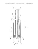 Methods and Apparatus for Endovascular Ultrasound Delivery diagram and image