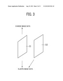 ULTRASONIC DIAGNOSTIC APPARATUS, METHOD FOR CONTROLLING DISPLAY OF IMAGE     AND CONTROL PROGRAM OF THE SAME diagram and image