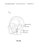 TREATMENT OF SUB-DERMAL REGIONS FOR COSMETIC EFFECTS diagram and image