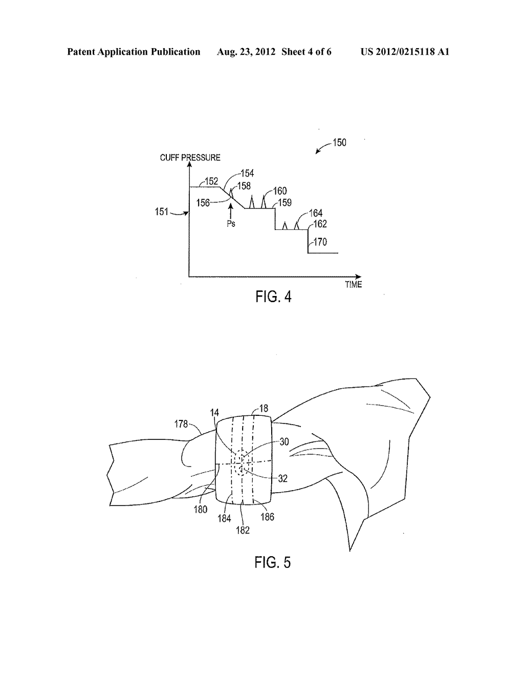 PATTERN OF CUFF INFLATION AND DEFLATION FOR NON-INVASIVE BLOOD PRESSURE     MEASUREMENT - diagram, schematic, and image 05