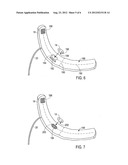 PATTERN OF CUFF INFLATION AND DEFLATION FOR NON-INVASIVE BLOOD PRESSURE     MEASUREMENT diagram and image