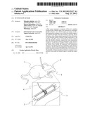 IN VIVO FLOW SENSOR diagram and image