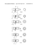 IN VIVO FLOW SENSOR diagram and image