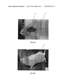 IN VIVO FLOW SENSOR diagram and image