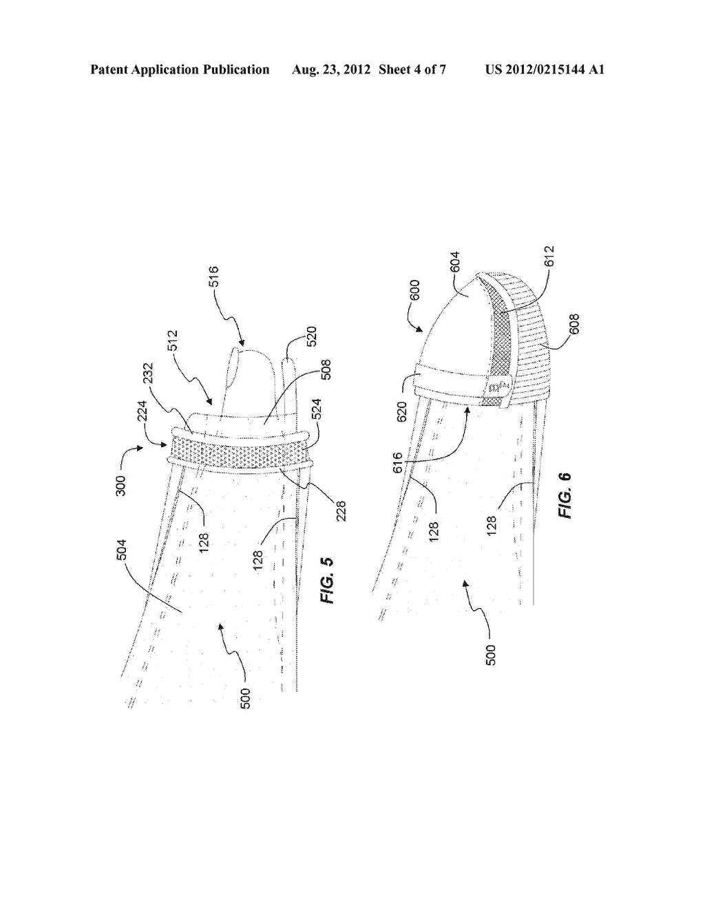 ORTHOPEDIC CAST COVER ANCHOR ASSEMBLY AND KIT FOR PROTECTING EXPOSED LIMBS - diagram, schematic, and image 05