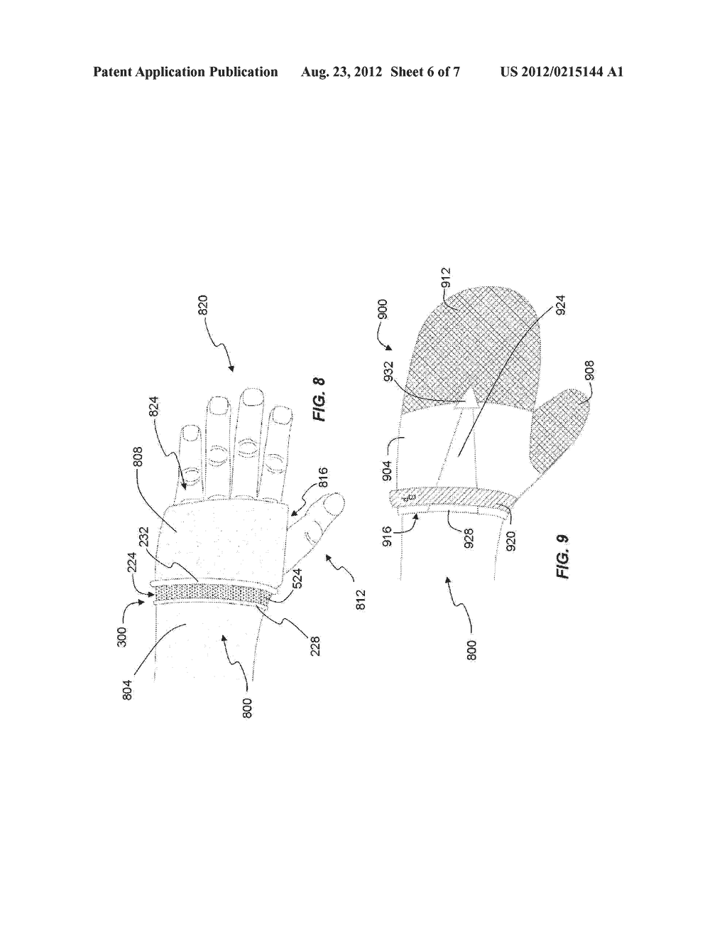 ORTHOPEDIC CAST COVER ANCHOR ASSEMBLY AND KIT FOR PROTECTING EXPOSED LIMBS - diagram, schematic, and image 07