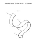 Supinating Arm and Elbow Brace diagram and image